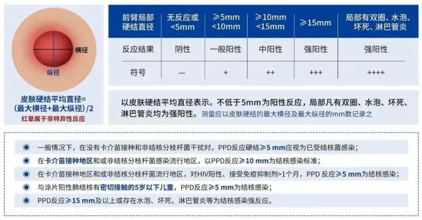 长沙芙蓉区定王台社区卫生服务中心肺结核筛查安排